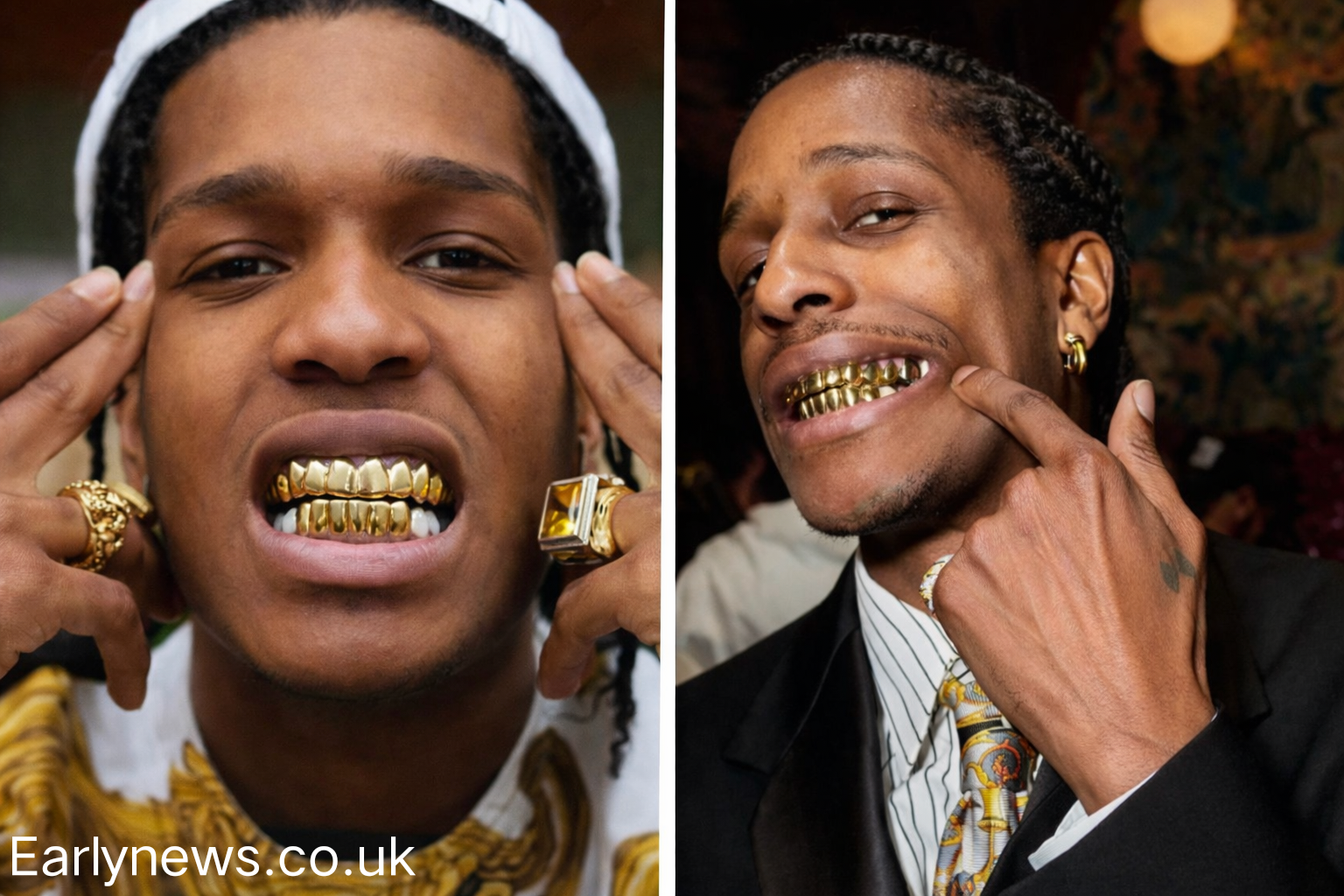 asap rocky grillz: Gold, Identity, and Hip-Hop Power Legacy