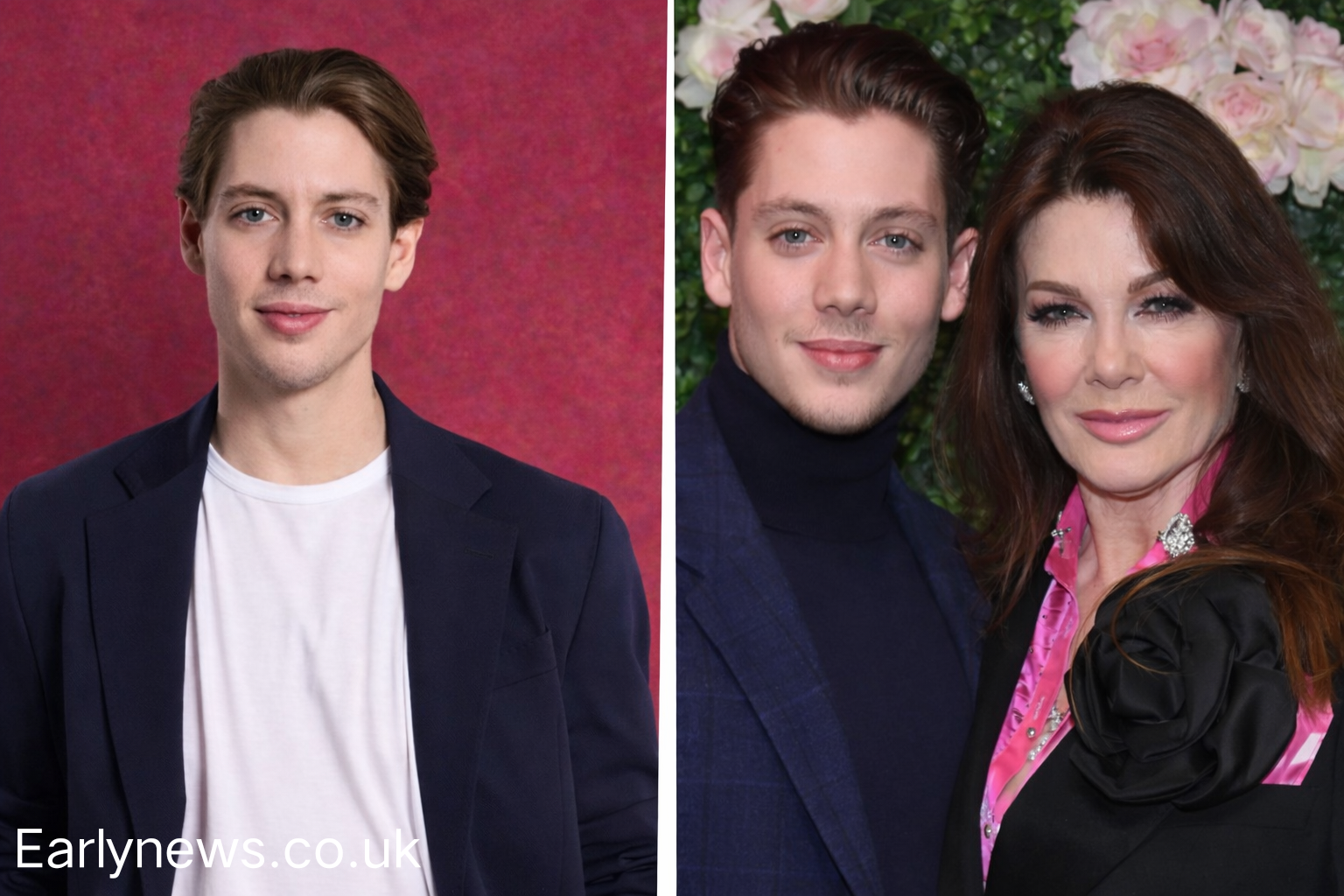 Sam Vanderpump: Courage, Fame, and a Life Rewritten