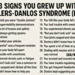 23 Signs You Grew Up with Ehlers-Danlos Syndrome (EDS)